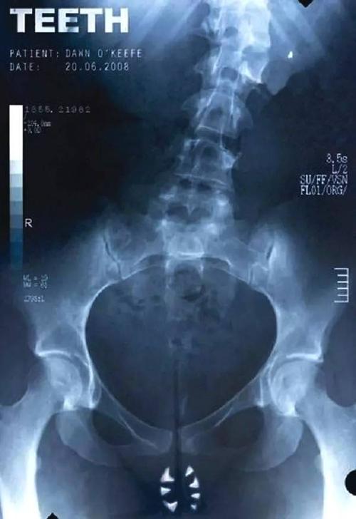 汉诺威兽医学院成绩单修改